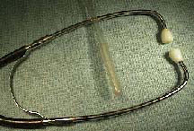 esophageal stethoscope