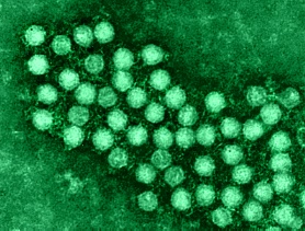 enterovirus
