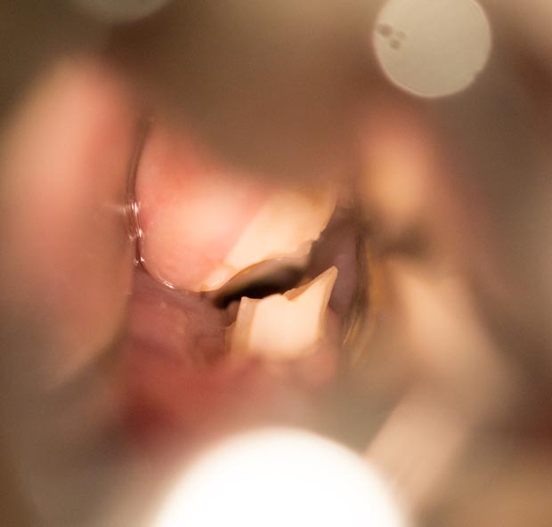 Molar points