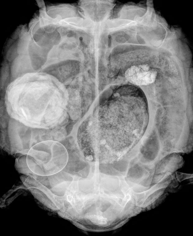 X-ray Stones