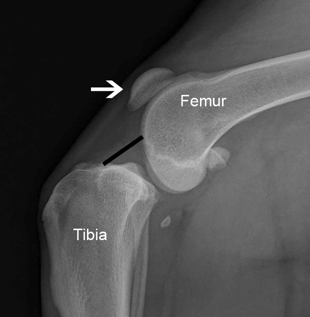 Ligament