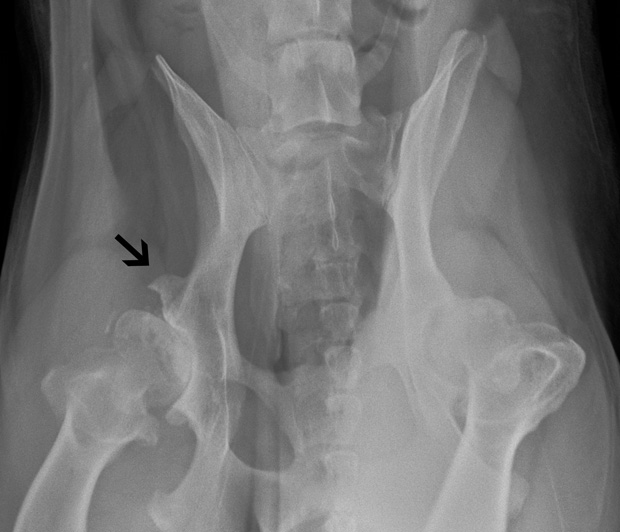 SevereHipDysplasia
