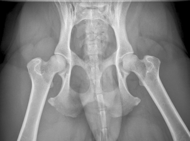 Normal hips