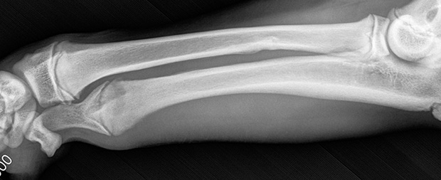 strong bones