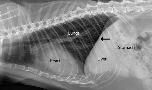If changes are heard in the lungs