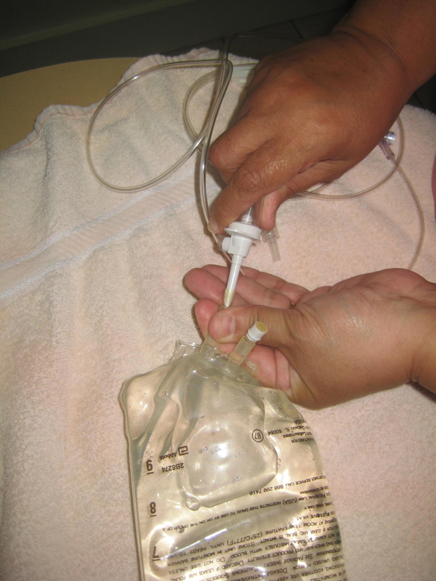 fluids