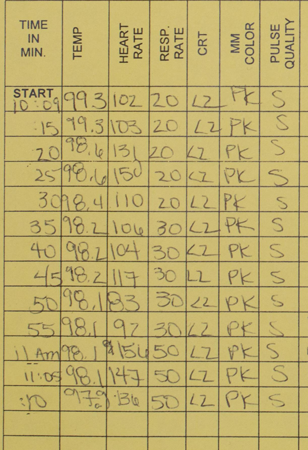 Follow parameters every five minuites