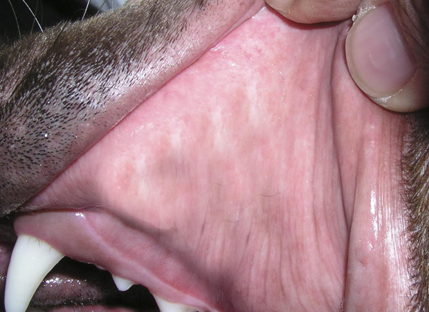 Gums