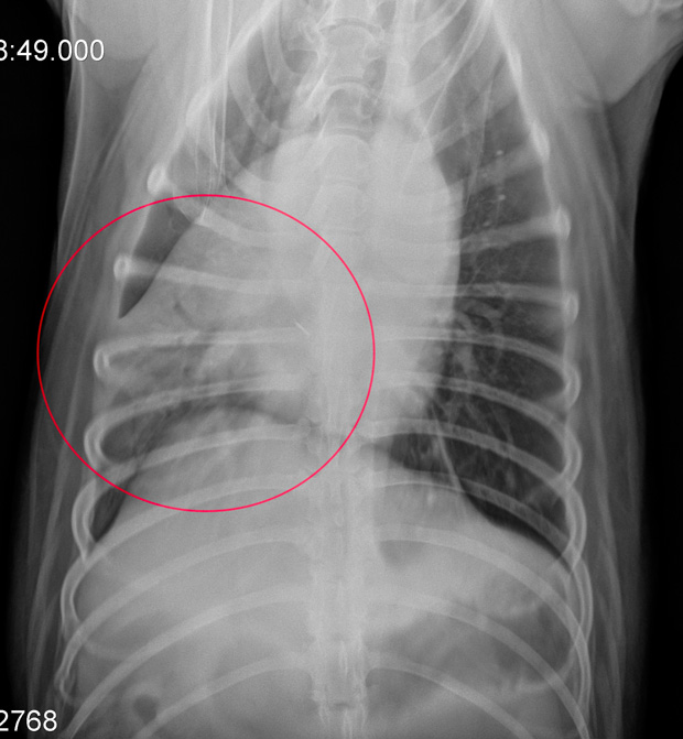 Pneumonia Rad