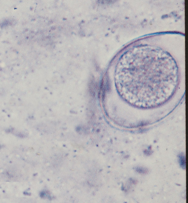 protozoan