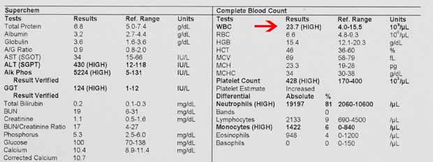 Blood count