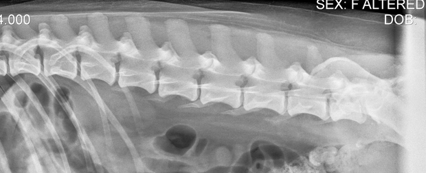 Spine
