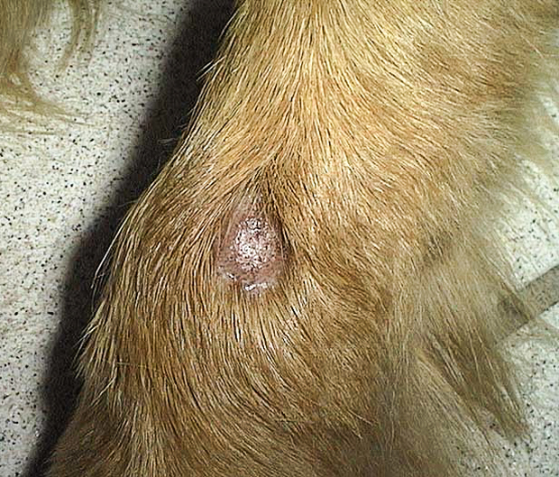 Lesion