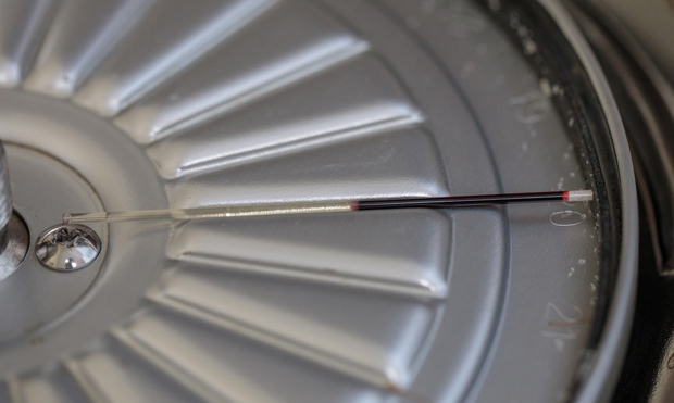 HCTCentrifuge